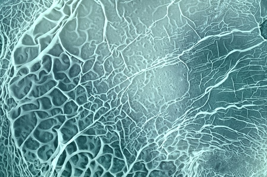 Acoustic membranes